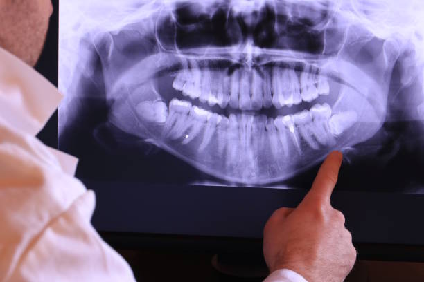 Best Emergency Dentist for Lost Fillings or Crowns in Four Corners, MD